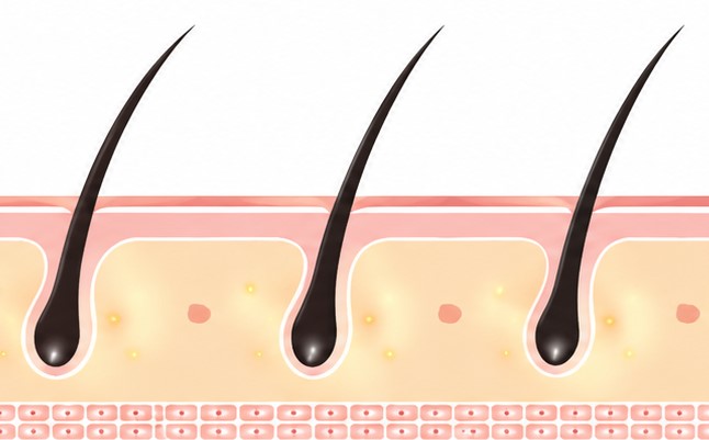 Clinical testing results showing improvement in hair density and reduced hair loss with Hisooth H3