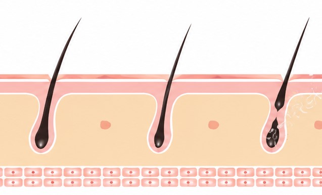 65.58% Less Hair Fall after 12 weeks of use Hisooth Clinical Testing